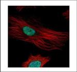 Fibrillarin Polyclonal Antibody