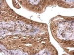 FUS Antibody in Immunohistochemistry (Paraffin) (IHC (P))