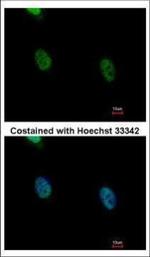 hnRNP K Polyclonal Antibody