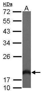 HPCAL1 Antibody in Western Blot (WB)