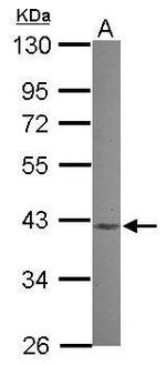 MVK Polyclonal Antibody