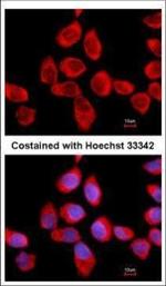 RPLP2 Polyclonal Antibody