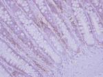 RPLP2 Antibody in Immunohistochemistry (Paraffin) (IHC (P))