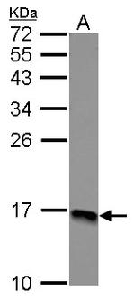 RPLP2 Antibody in Western Blot (WB)