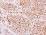 NDUFS5 Polyclonal Antibody