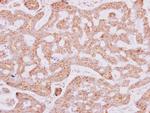 RPL15 Polyclonal Antibody