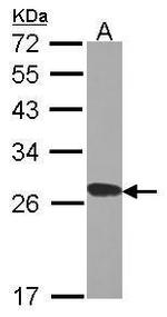 RPL15 Antibody in Western Blot (WB)