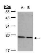 RPL17 Polyclonal Antibody