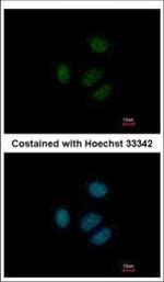RPS15 Polyclonal Antibody