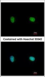 Ku70 Polyclonal Antibody