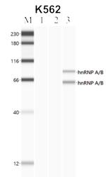 hnRNP AB Antibody in RNA Immunoprecipitation (RIP)