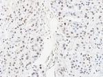 hnRNP AB Antibody in Immunohistochemistry (Paraffin) (IHC (P))