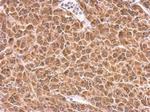 PRKCSH Antibody in Immunohistochemistry (Paraffin) (IHC (P))