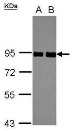 PRKCSH Antibody in Western Blot (WB)