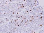 HLA-DRA Polyclonal Antibody