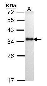 HLA-DRA Antibody in Western Blot (WB)