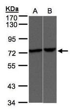 TRPV2 Antibody in Western Blot (WB)