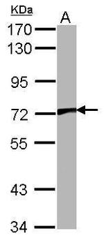 TRPV2 Antibody in Western Blot (WB)