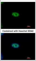 NYREN18 Polyclonal Antibody