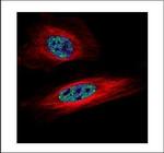 SNRPB Polyclonal Antibody