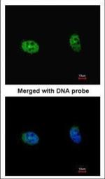 RPS6KB2 Polyclonal Antibody