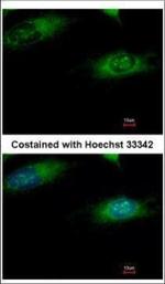 Ribophorin I Polyclonal Antibody