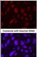 Rex1 Antibody in Immunocytochemistry (ICC/IF)