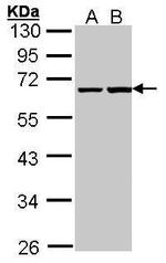 PHF1 Polyclonal Antibody