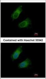 GOT2 Polyclonal Antibody