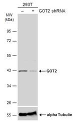 GOT2 Antibody in Western Blot (WB)