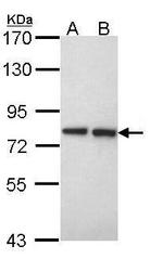 EXT2 Polyclonal Antibody