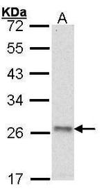 ATP Synthase O Antibody in Western Blot (WB)