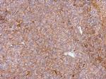 PHGDH Antibody in Immunohistochemistry (Paraffin) (IHC (P))