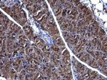 PHGDH Antibody in Immunohistochemistry (Paraffin) (IHC (P))