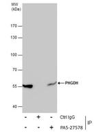 PHGDH Antibody in Immunoprecipitation (IP)