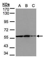PHGDH Antibody in Western Blot (WB)