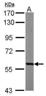 PHGDH Antibody in Western Blot (WB)