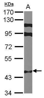 ZNF384 Antibody in Western Blot (WB)