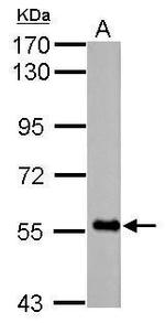 FBXO7 Polyclonal Antibody