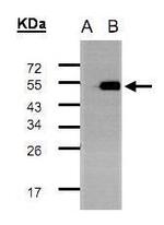 TADA3L Polyclonal Antibody