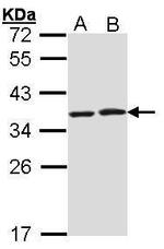 HAX1 Antibody in Western Blot (WB)
