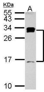 C1D Polyclonal Antibody