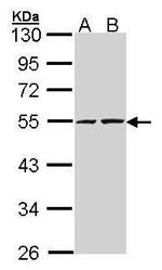 RUVBL2 Antibody in Western Blot (WB)