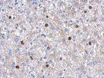 MYST2 Polyclonal Antibody