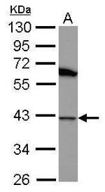 HSP40 Polyclonal Antibody