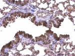 DIAPH1 Antibody in Immunohistochemistry (Paraffin) (IHC (P))