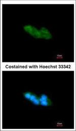 ARMET Antibody in Immunocytochemistry (ICC/IF)