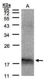 ARMET Antibody in Western Blot (WB)