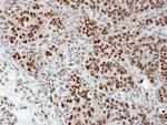 hnRNP H1 Antibody in Immunohistochemistry (Paraffin) (IHC (P))
