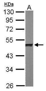 hnRNP H1 Antibody in Western Blot (WB)